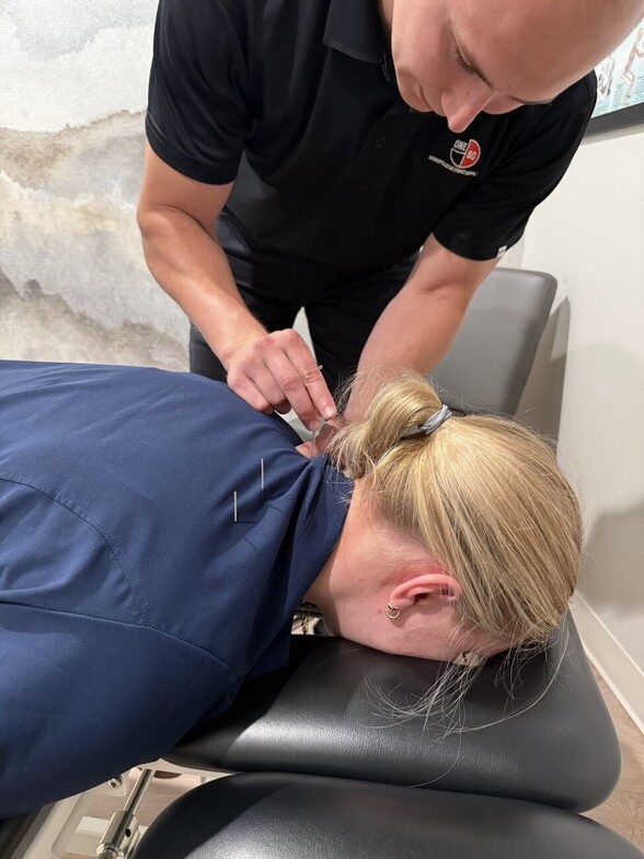 Dr. Brett Classen performing dry needling on the neck and upper back for tension headache relief at One80 Chiropractic in Omaha